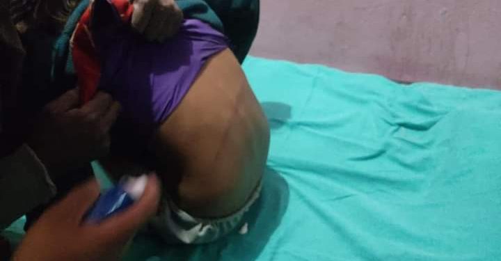 बाख्राले कोबि खायेको निहुमा एक बालिकामाथि निर्घात कुटपिट गरेकाे खुलासा