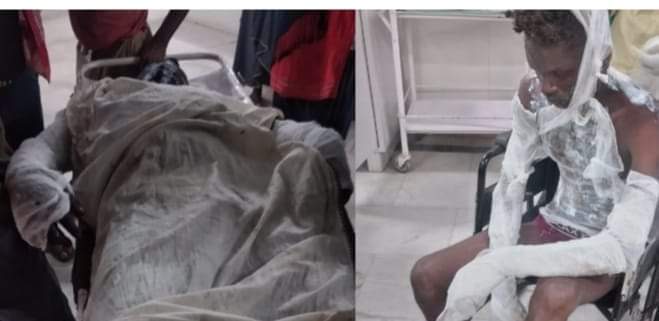 सामुहिक बलात्कार गर्ने दुई जनालाई स्थानियले जलाए जिउदै