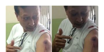 प्रहरीकाे गोली लागेर एक पत्रकारसमेत घाइते